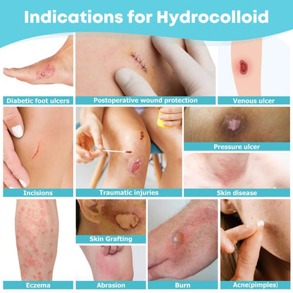 LIFARA Hydrocolloid Acne Roll