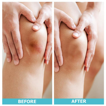 LIFARA Hydrocolloid Acne Roll